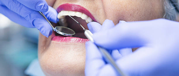 Best Emergency Root Canal Therapy in Warrensburg, MO
