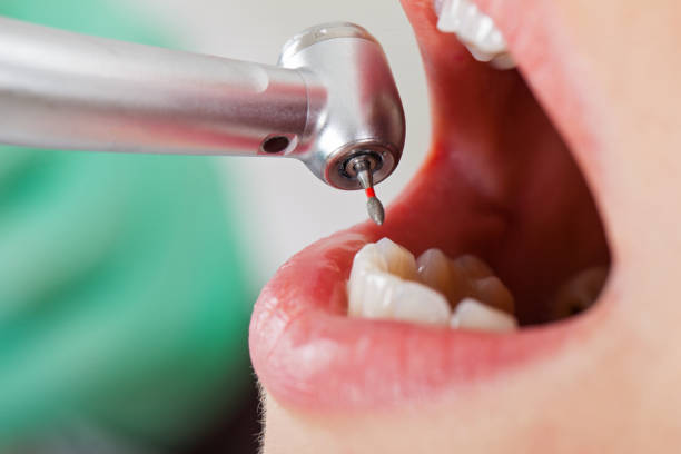 Best Emergency Treatment for Jaw Pain or Injury in Warrensburg, MO